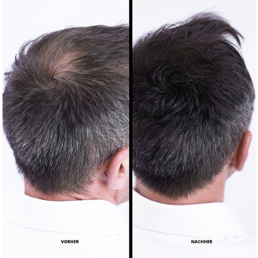 Super Million Hair Haarfasern Gray (11)